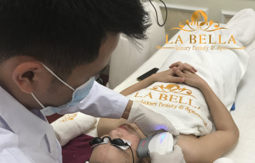 Chị khách sử dụng dịch vụ HIFU nâng cơ trẻ hoá toàn mặt cùng chuyên gia La Bella
